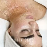 ماسک کانتورینگ ارفلند ایتالیا