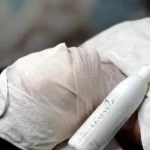 پک کربوکسی تراپی لکسینا Lexina
