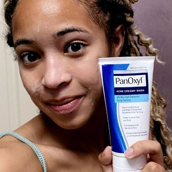 فوم شوینده ضدجوش پانوکسیل 170گرم (4) فوم شوینده ضدجوش پانوکسیل 170گرم